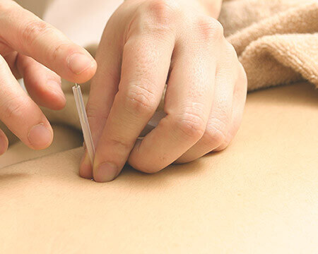 鍼治療＋マッサージ